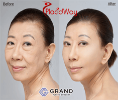 Slider image (3) Grand Plastic Surgery